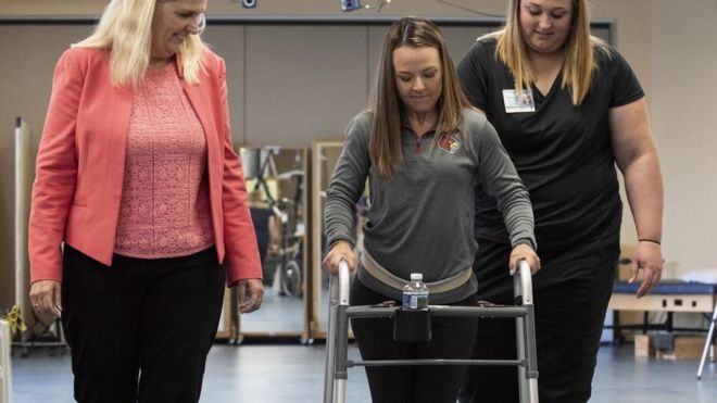 Lần đầu tiên trên thế giới, ba bệnh nhân liệt hai chân đã có thể đi lại được nhờ một thiết bị điện tử gắn vào tủy sống của họ. Đột phá này mang lại hy vọng đi lại cho hàng triệu người phải ngồi xe lăn vì liệt chân. 