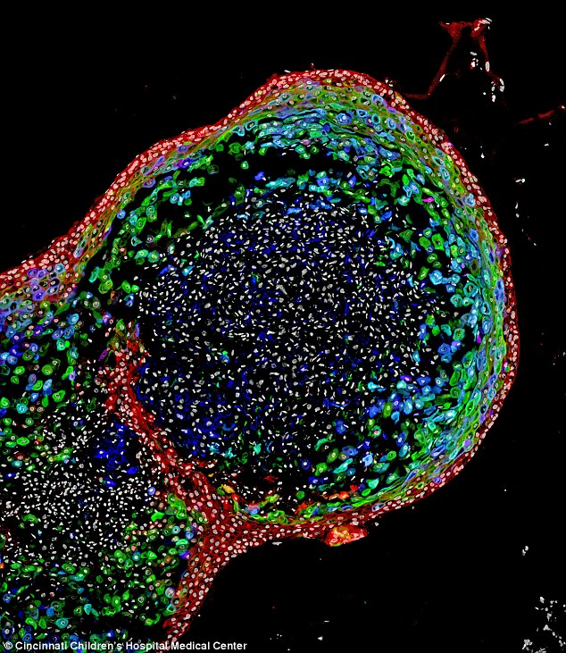 Lần đầu tiên các nhà khoa học đã làm ra thành công thực quản bằng chính tế bào gốc của bệnh nhân, mở ra triển vọng chế tạo cả hệ thống tiêu hóa để nghiên cứu bệnh lý.